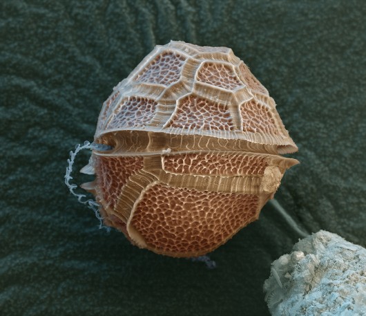 e_microscope_image_10