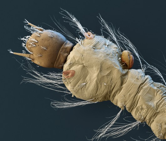 e_microscope_image_11