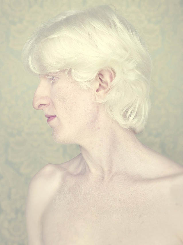 Gustavo-Lacerda-Albinos-1